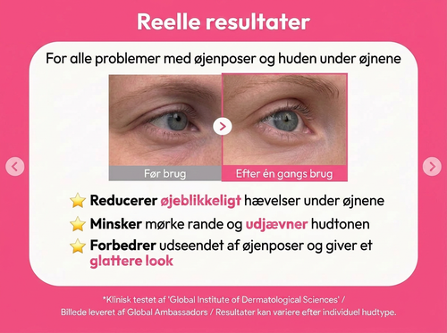 Eye Patches – Mod mørke rande og poser under øjnene