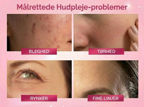 MultiBalm – Maksimal fylde, øjeblikkelig effekt