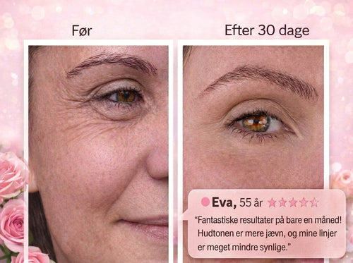 Eye Patches – Mod mørke rande og poser under øjnene