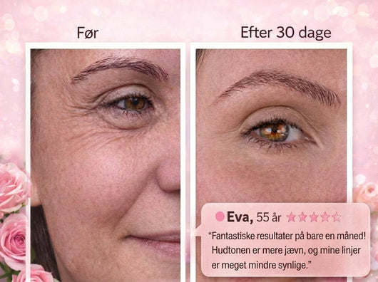 Eye Patches – Mod mørke rande og poser under øjnene